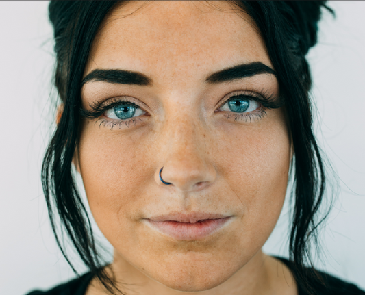 Figure 1: It shows a young lady with sun spots, brown spots, age spots and premature sun skin aging