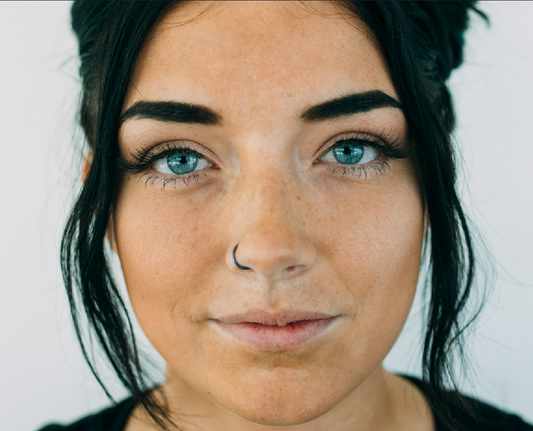 Figure 1: It shows a young lady with sun spots, brown spots, age spots and premature sun skin aging   